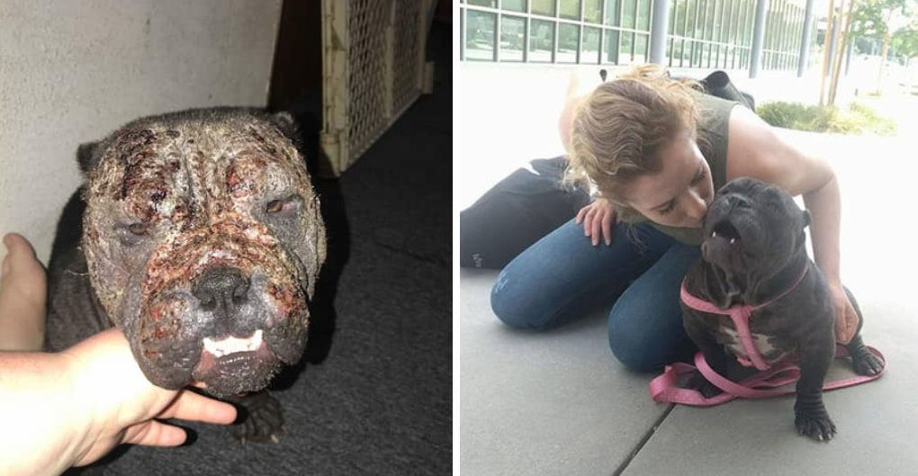 Severely Neglected Girl Gets a Chance at Forever